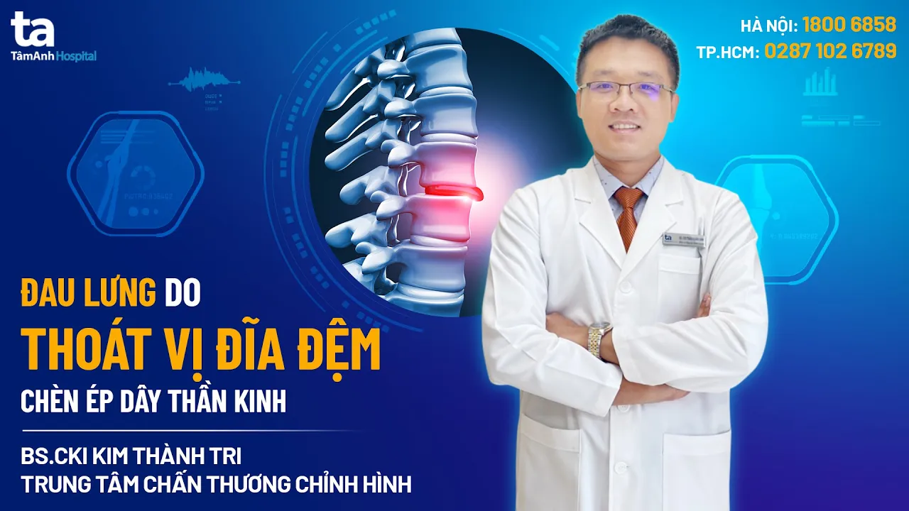 Outline Video Đau lưng do thoát vị đĩa đệm, chèn ép dây thần kinh | BS.CKI Kim Thành Tri | CTCH Tâm Anh