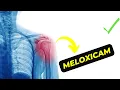 Meloxicam How It Works Side Effects and Optimal Dosage