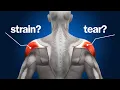Top 3 Ways To Tell A Shoulder Strain Apart From A Rotator Cuff Tear