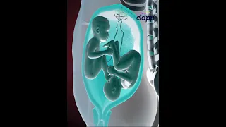 Twins struggles inside the Womb for supremacy 3D Animation