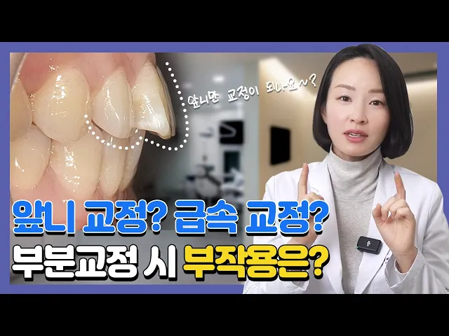 ()3개월이면 끝나는 치아교정이 있다? 부분교정, 급속교정 부작용은 없을까? 교정학박사가 알려드려요.