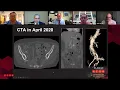 Dr. Jason T. Lee presents a Complex Suprarenal Case