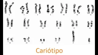 What is a Karyotype test? (CC)