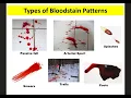 Blood Spatter Notes Forensics