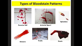 Blood Spatter Notes Forensics