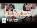 A plastic surgeon discusses his new children s book of acceptance