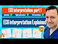 interpretation The animated Visual Guide with ECG Criteria