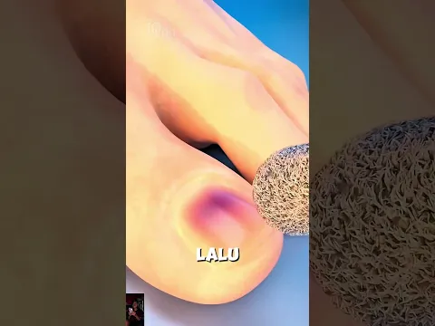 MENCABUT KUKU KAKI