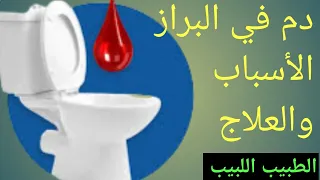 دم في البراز الاسباب والعلاج 