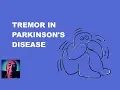 Download Lagu Vlog #111   Tremor And Parkinson's Disease