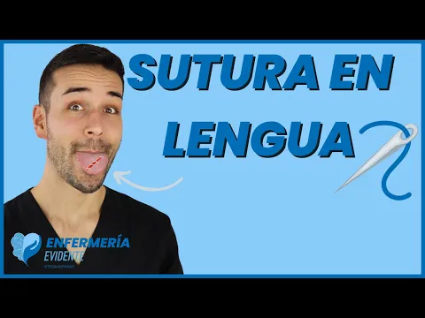 Download MP3 🛑SUTURA de LENGUA❓... EVITA COMPLICACIONES😛