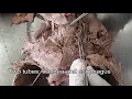 Download Lagu Thyroid gland - Dissection