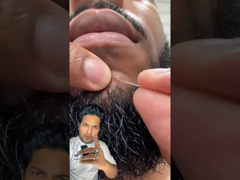 #ytshorts
