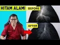 Download Lagu Cara Mengatasi Ubanan Rambut Putih Secara Alami - dr Saddam Ismail