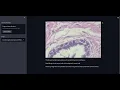 Image Classification model using tensorflow
