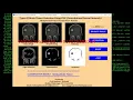 Types of Brain Tumor Detection Using CNN Python Project With Source Code Tumor Identification