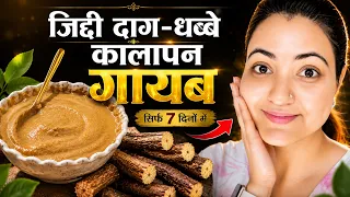 त्वचा की मुश्किल समस्या जैसे झाइयाँ Hyper pigmentation, Dark Spots , Melasma का 100% इलाज़💕