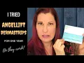 DO ANGELLIFT DERMASTRIPS REALLY WORK Angel Lift Before and After 1 Year Results