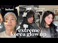 I spent in Korea so you don t have to the skin treatments that were worth it