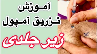 آموزش عملی تزریق زیر جلدی تزریق  زیرجلدی آمپول انوکساپارین دور ناف دندنها