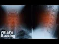 Download Lagu Wat gebeurt er als je je nek kraakt IN 60 SECONDEN!!