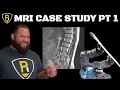 Download Lagu MRI Case Study: Why They Matter and Why They Don’t Tell the Whole Story