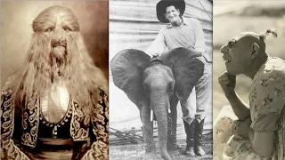 Heartbreaking Backstories Of Famous Sideshow Freaks
