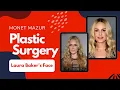 Monet Mazur Plastic Surgery What Happened To Laura Baker s Face