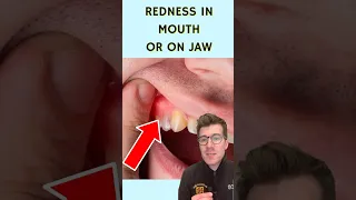7 signs of a dental abscess