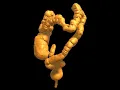 Redundant Colon