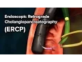Pediatric ERCP Cincinnati Children s