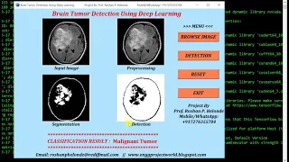 Python Code for Brain Tumor Detection Using Deep Learning Neural Network Full Source Code