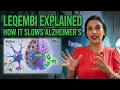 Leqembi Explained How Lecanemab Slows Alzheimer s