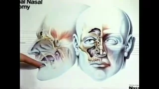 Tonsillectomy and Adenoidectomy-Dr Michael Seidman MD