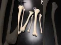 Identifying Bones of the Arms and Legs