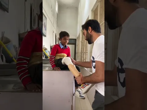Artificial leg walk fitting/ # #prosthetics #shorts #shortsviral #shortsfeeds #hassanzarar #heelpain