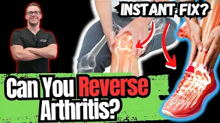 Download BEST 5 Ways to STOP Arthritis Pain [Big 2023 New SECRETS!] MP3