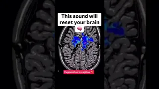 This Sound Resets Your Brain In 12 Seconds 432 Hz Golden Ratio Instant Calm Clarity 