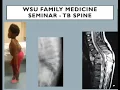 TB Spine Tutorial WSU June 2021 WSU Family Medicine