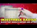 Injectable RAD140 Blood Test Results Before And After - Injectable SARMs Research
