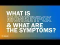 Monkeypox Know the Facts- What Is Monkeypox and What Are the Symptoms