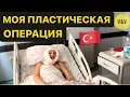 Download Lagu МОЯ ПЛАСТИЧЕСКАЯ ОПЕРАЦИЯ В ТУРЦИИ. ЛИФТИНГ ЛИЦА, БУЛХОРН, РЕАБИЛИТАЦИЯ #подтяжкалица #пластикалица