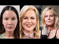 15 Hollywood Stars Whose Facelifts Went Too Far It s Getting Worse