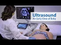 ULTRASOUND An Early View of Baby