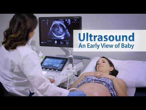 Download MP3 ULTRASOUND: An Early View of Baby