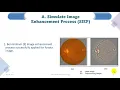 Diabetic Retinopathy Classification with pre-trained Image Enhancement Model