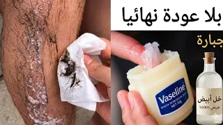 كيفية استخدام الفازلين والخل‼️ للتخلص من شعر الوجه والجسم والعانة بدون ألم وبلا عودة نهائياوصفات