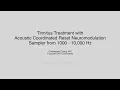Tinnitus Treatment with Acoustic Coordinated Reset Neuromodulation Tone Samples for 1000 - 10,000 Hz