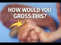 How to Answer How Would You Gross This Specimen PA Interview Prep