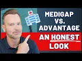 Medicare Advantage vs Medicare Supplement 2026 Full Comparison